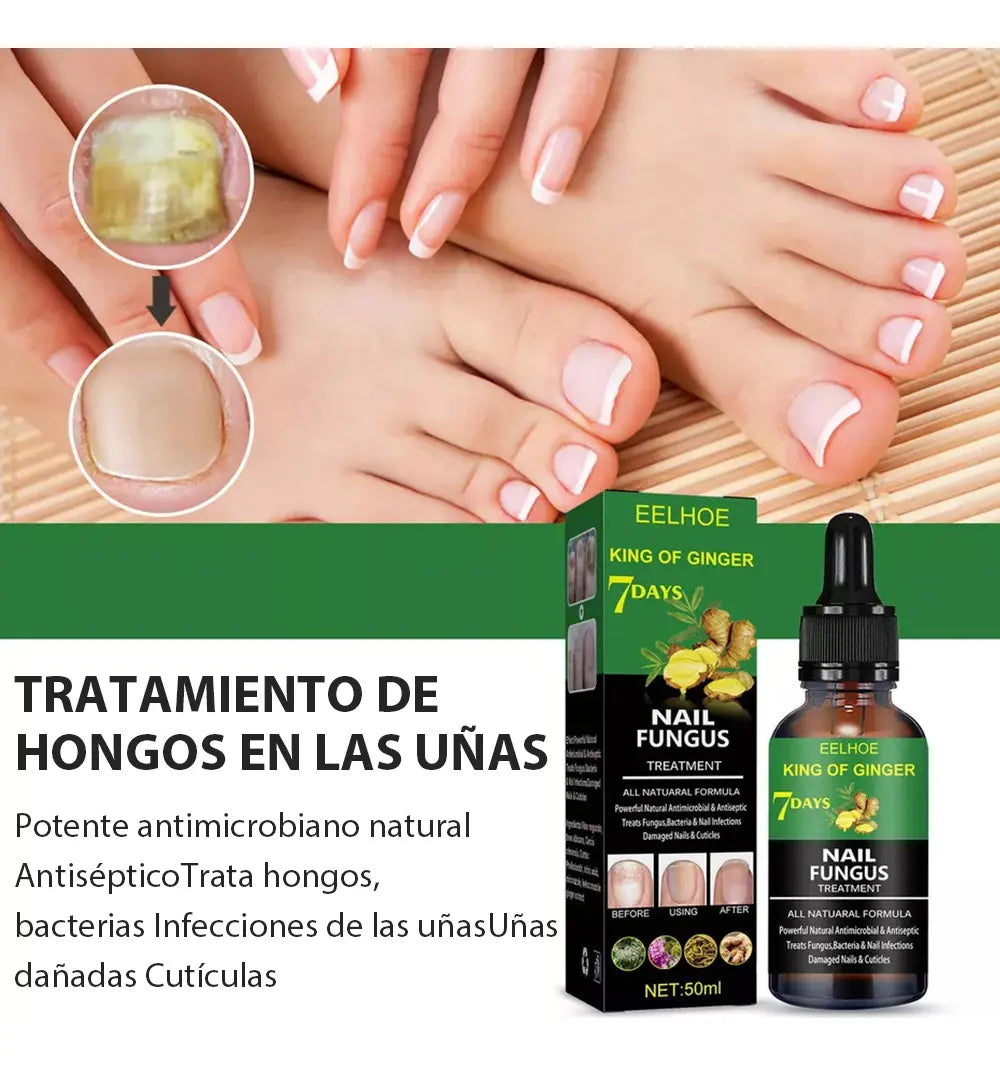 Tratamiento para elimina hongos en 7 días  X2 UND. ENVIO GRATIS