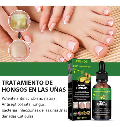 Tratamiento para elimina hongos en 7 días  X2 UND. ENVIO GRATIS