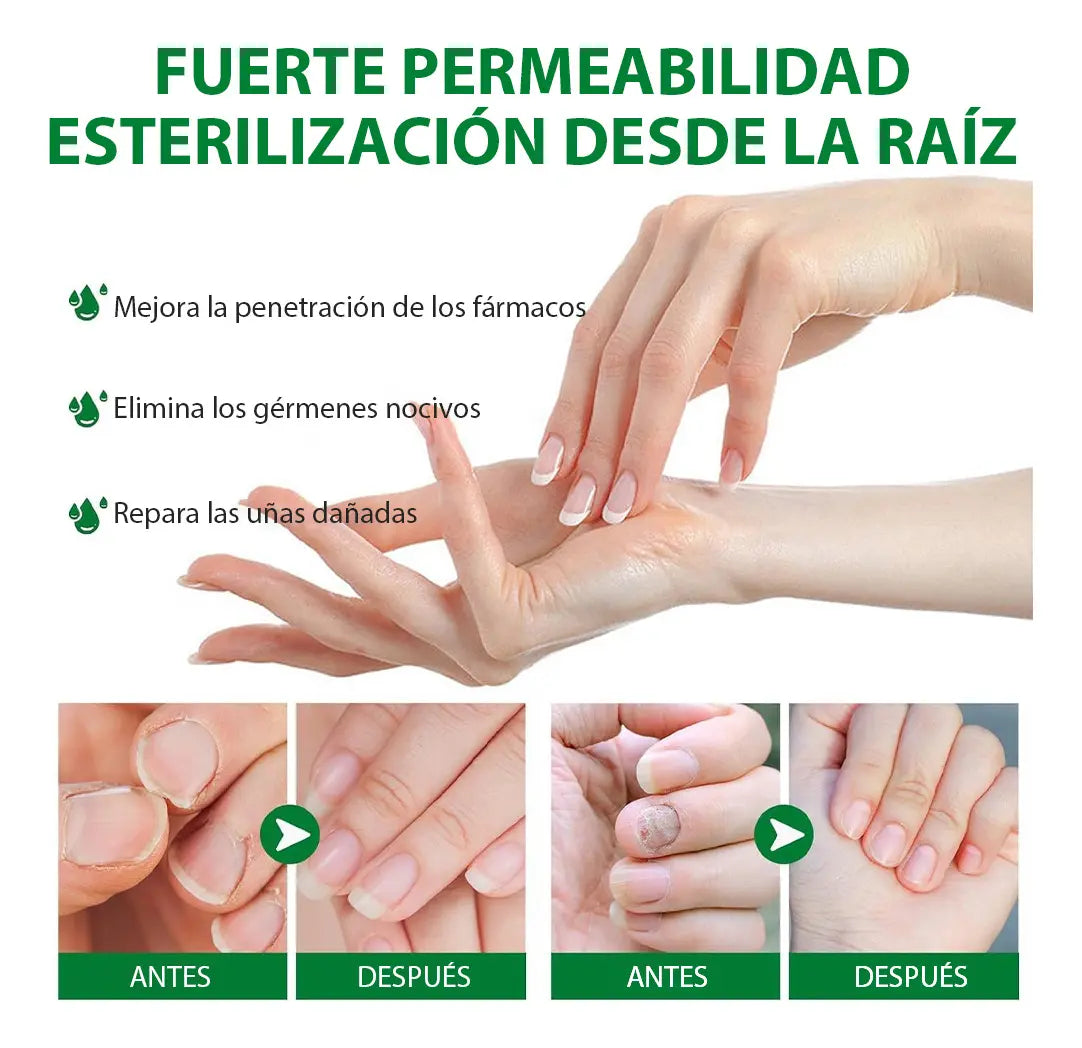 Tratamiento para elimina hongos en 7 días  X2 UND. ENVIO GRATIS