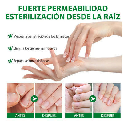 Tratamiento para elimina hongos en 7 días  X2 UND. ENVIO GRATIS