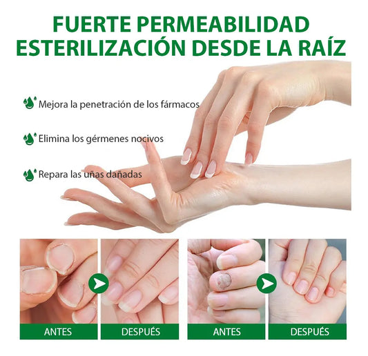 Tratamiento para elimina hongos en 7 días  X2 UND. ENVIO GRATIS